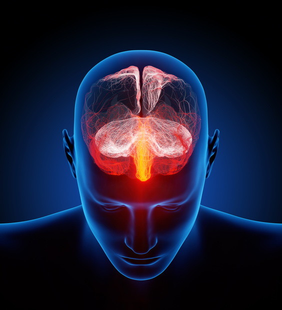 Diffuse Axonal Injury From Truck Accident