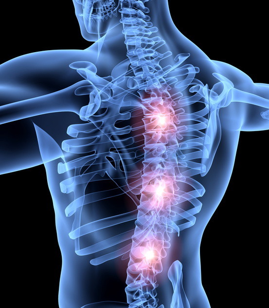 Suffering from a Herniated Disc After Car Accident?