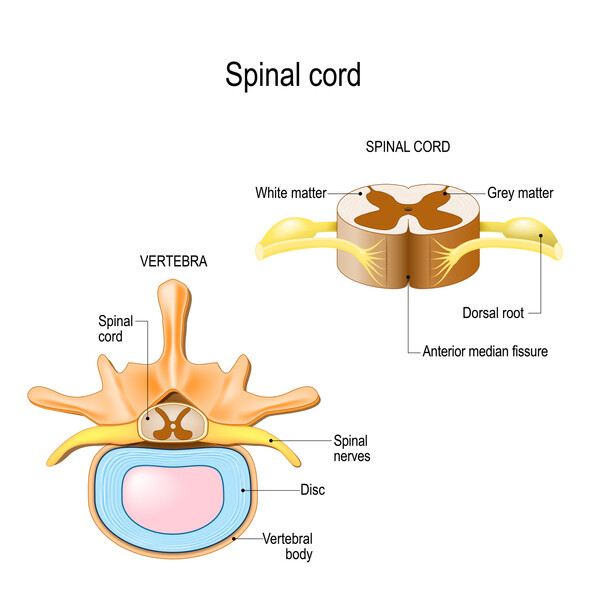 What is Spinal Cord Syndrome and how does it relate to pain from an accident