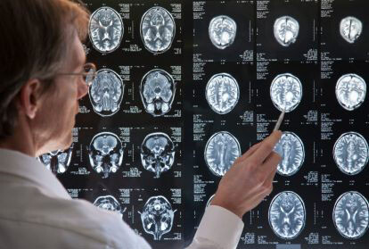 sacramento brain injury attorney